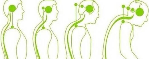 A columna cervical perde a mobilidade