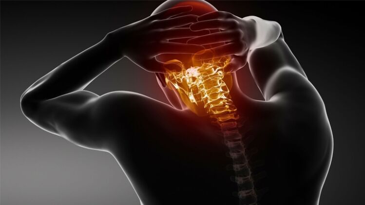 Dor na parte posterior da cabeza con osteocondrose cervical